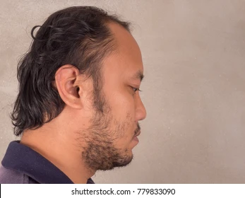 Side view asian bald head 260nw 779833090