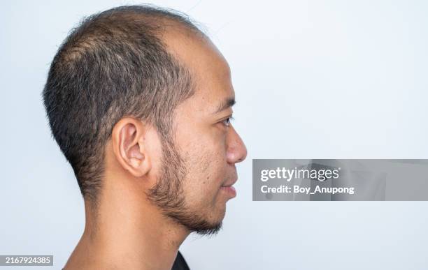 Gettyimages 2167924385 612x612