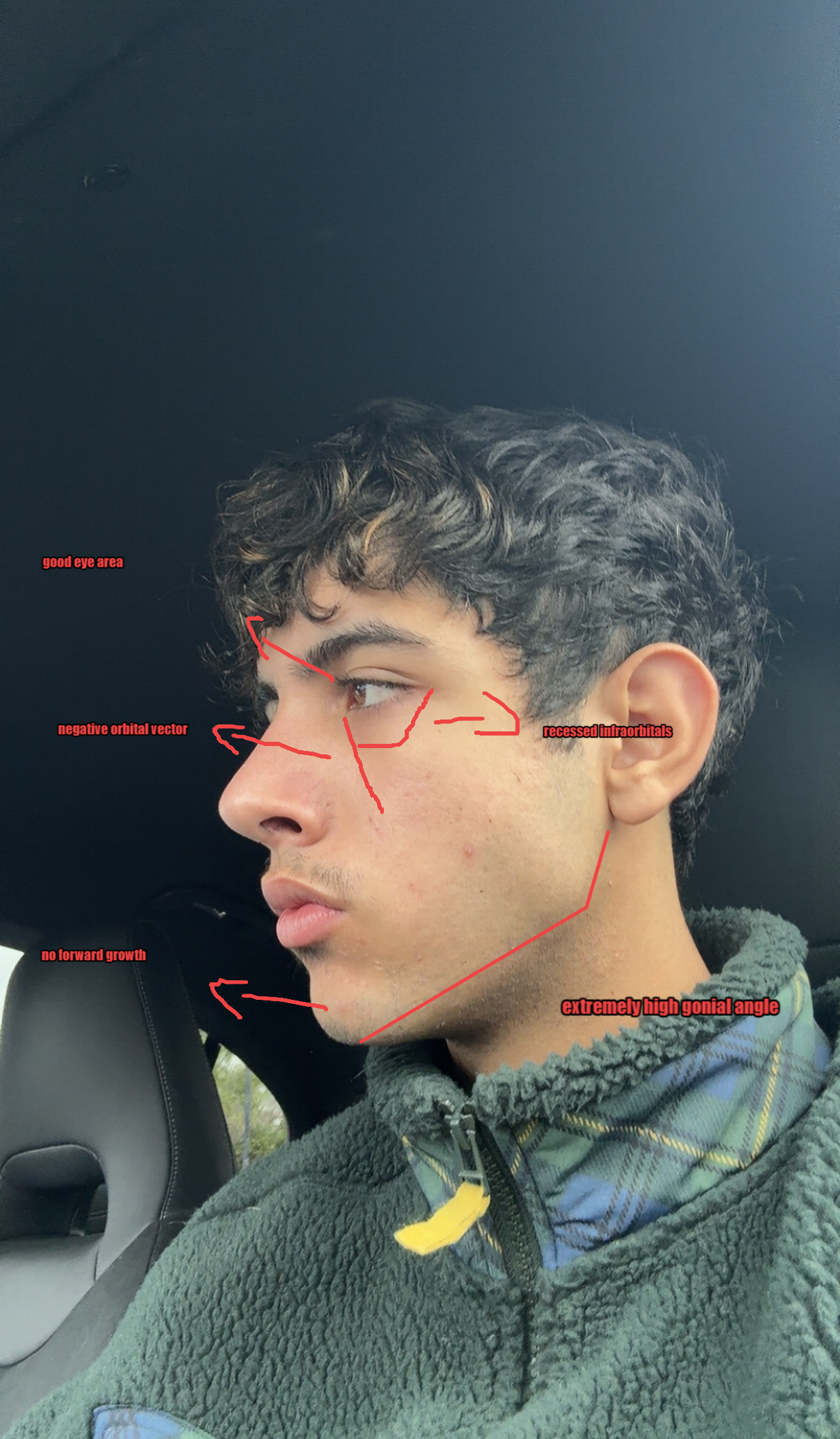 Glitch pro 1767850702824