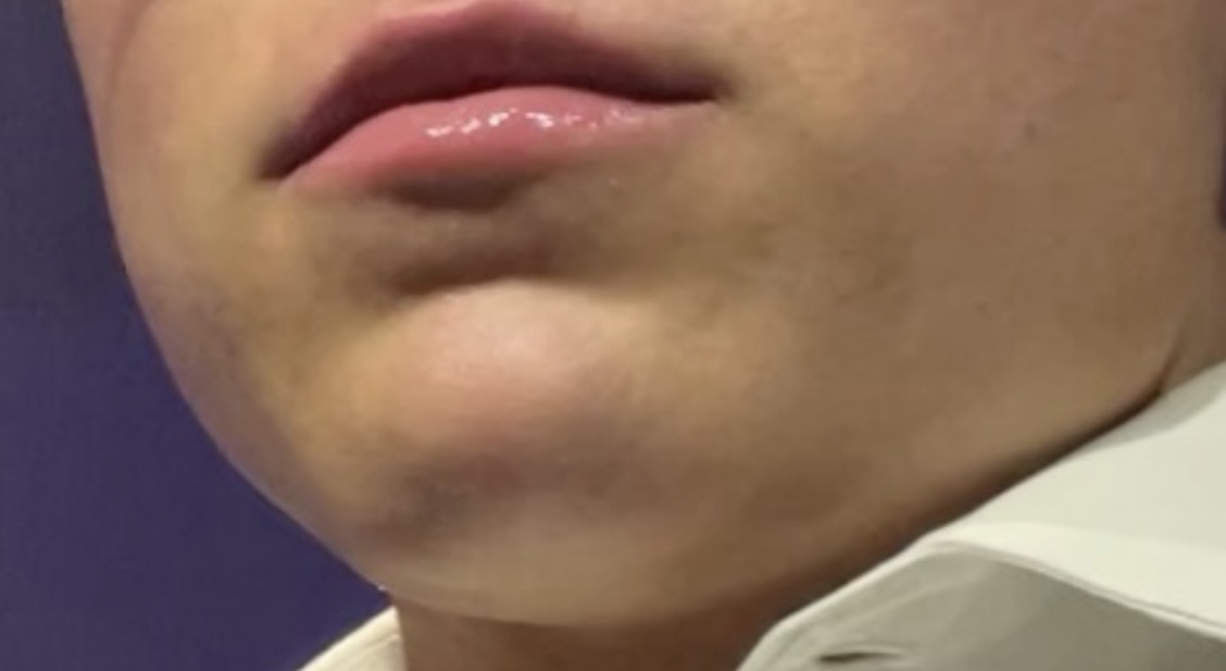 CB17A681 03EE 4856 860D 006ED44AFBD8 1 201 a