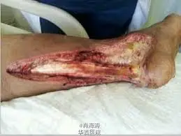 17664811983f wrqIZUmB9gA