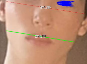 882