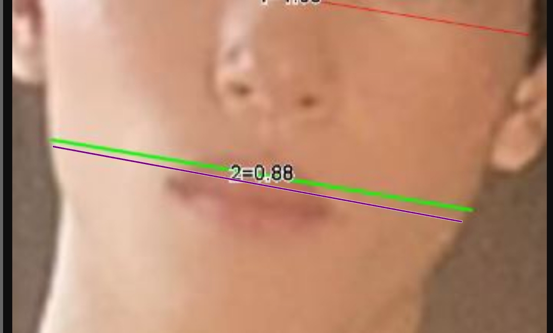 1000032015