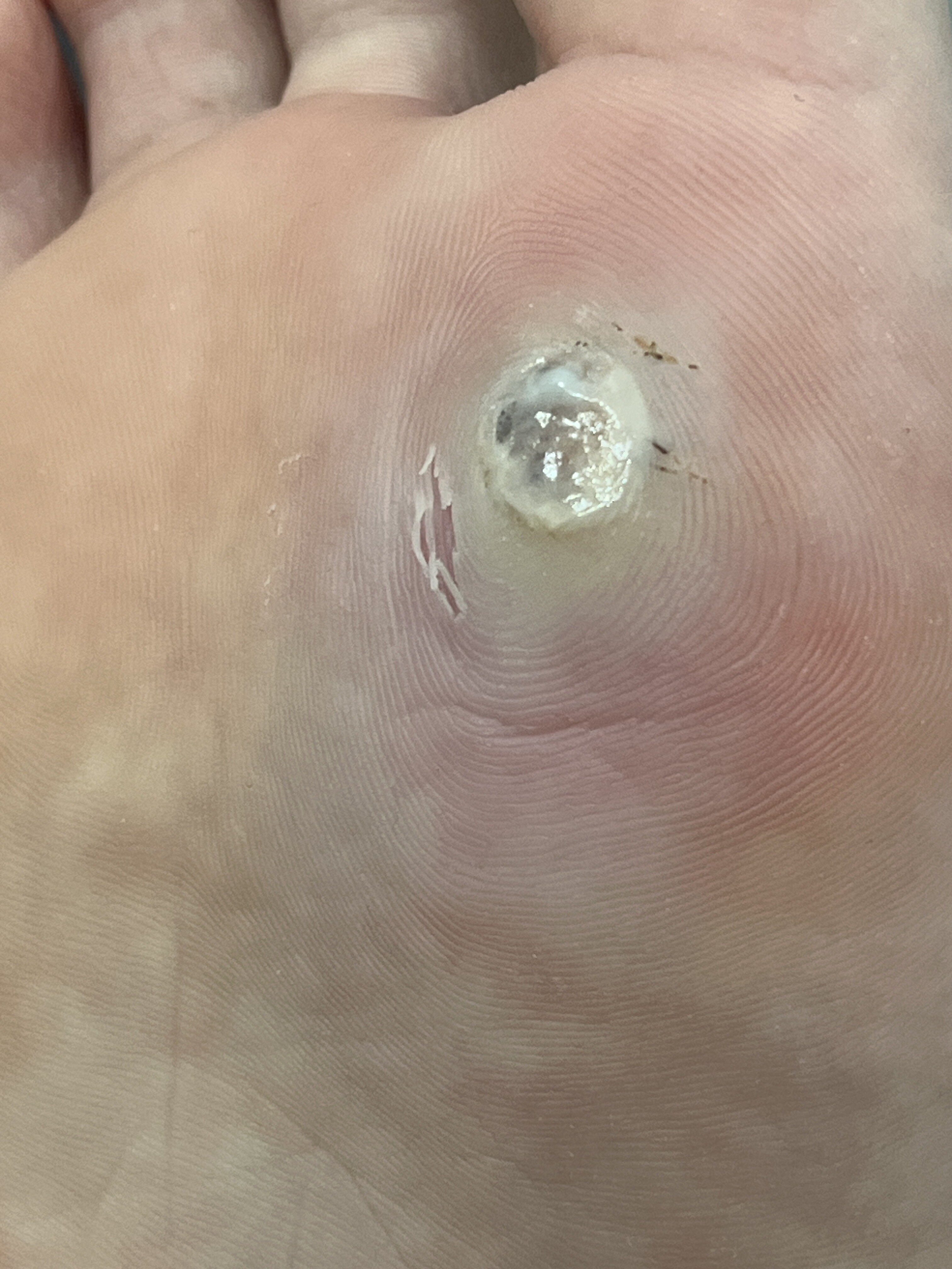 IMG 8D7DE16D 6565 451F 8C15 72ED37887700