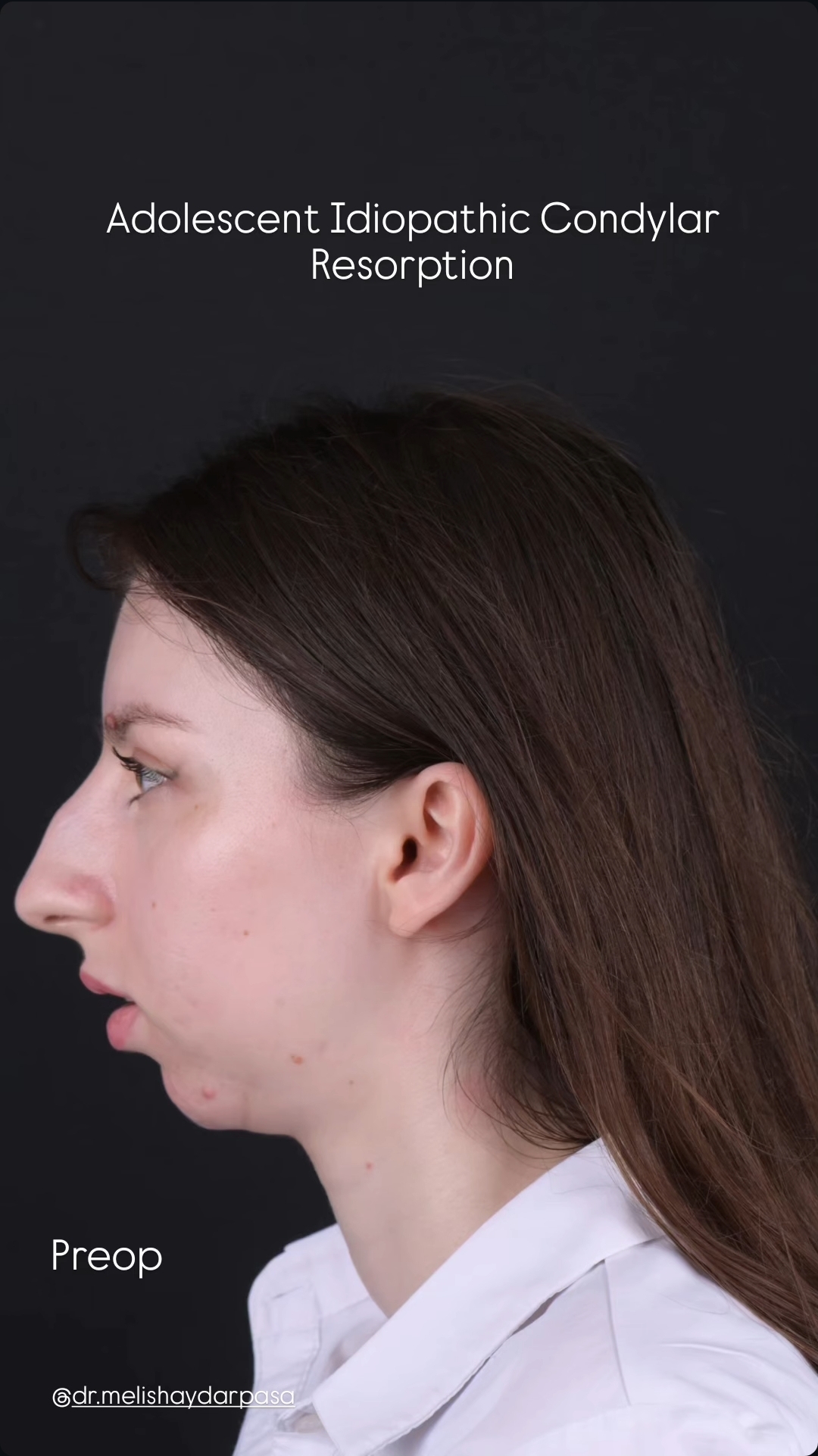 Screenshot 20260116 190112 Instagram