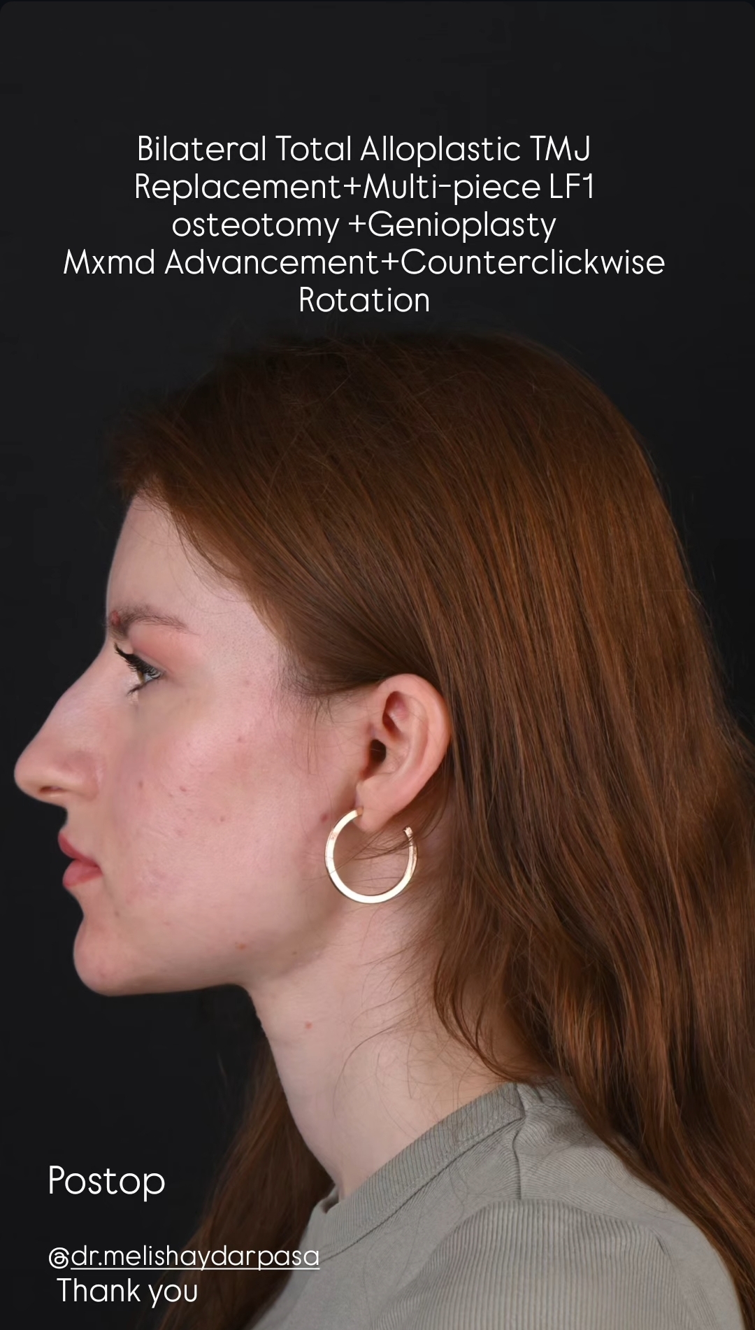 Screenshot 20260116 190119 Instagram