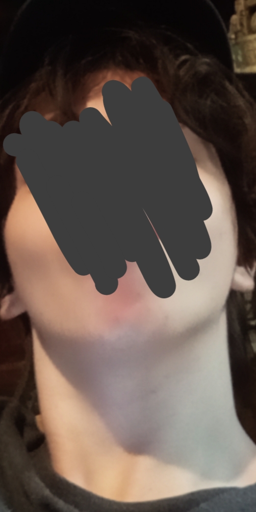 1000032590