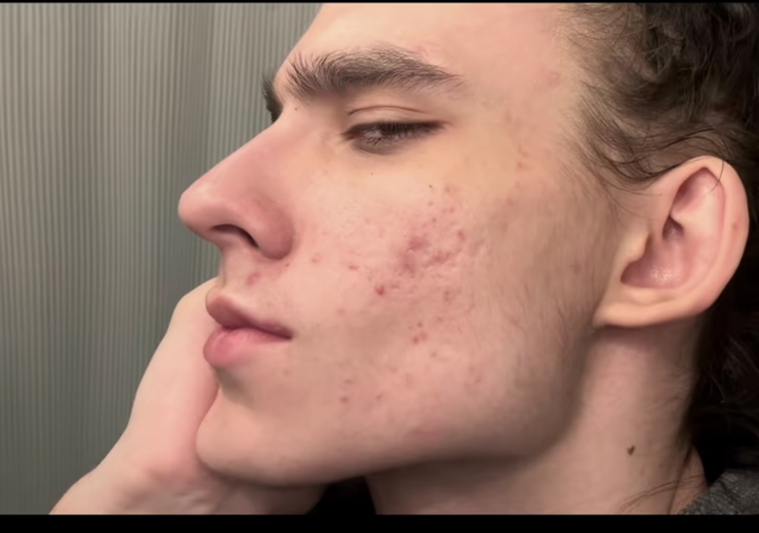 Screenshot 2026 01 18 22 41 32 910 comzhiliaoappmusically edit