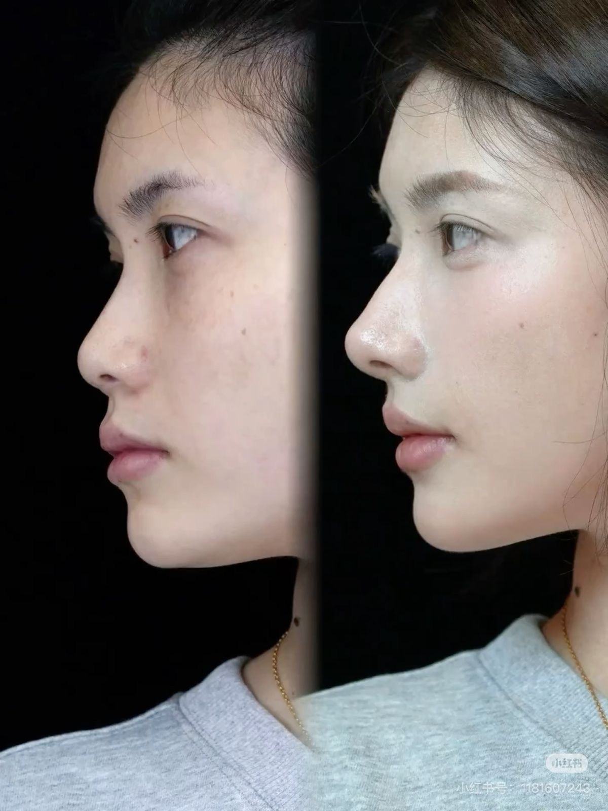 B47914CE 58A4 46E1 A8C8 0385022FD021