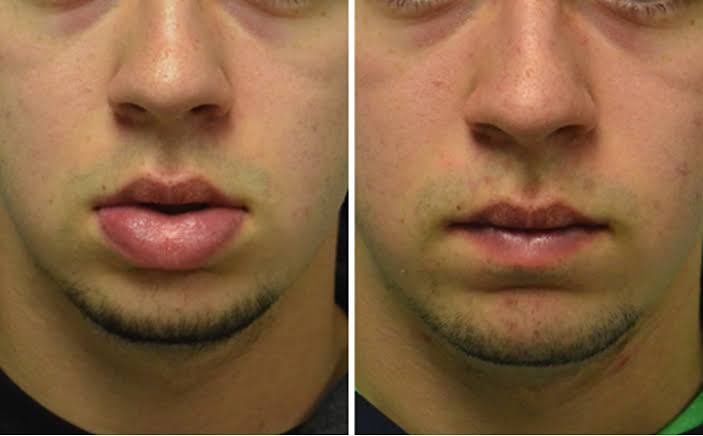 41EE79A3 83E8 4EB6 82CD 90A4D16DDD2B