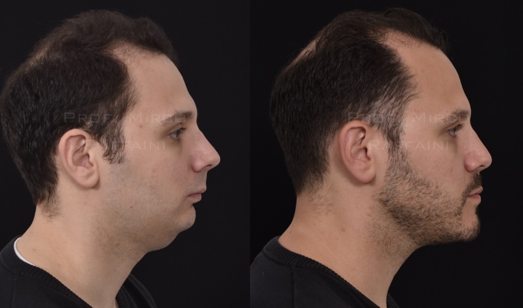 Screenshot 20260119 111148 Instagram