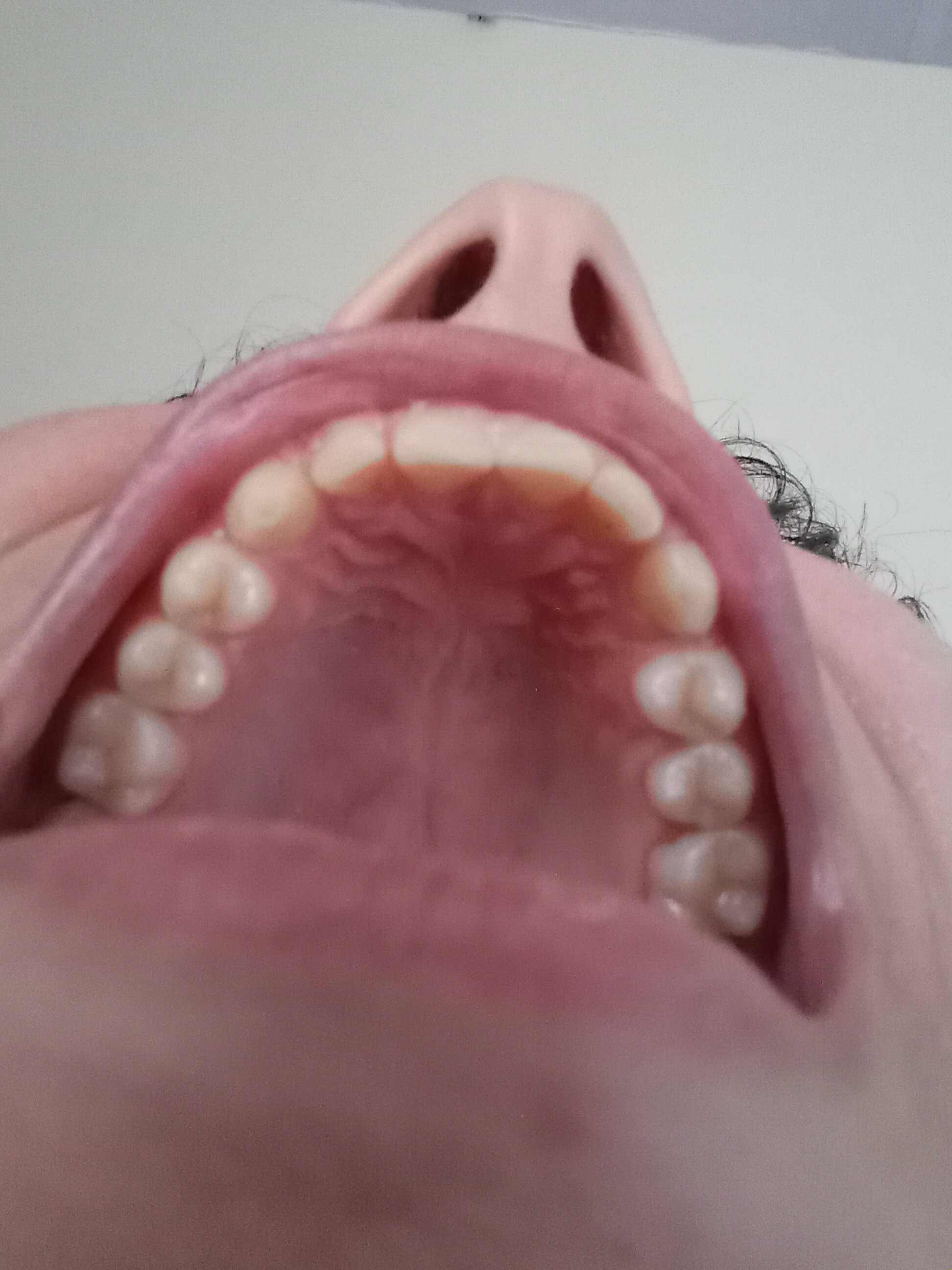 1000039809