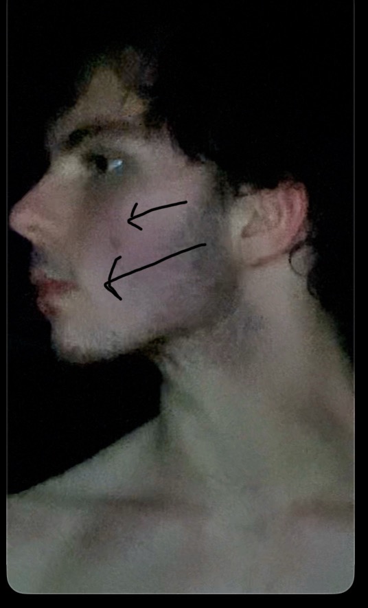 IMG 2539