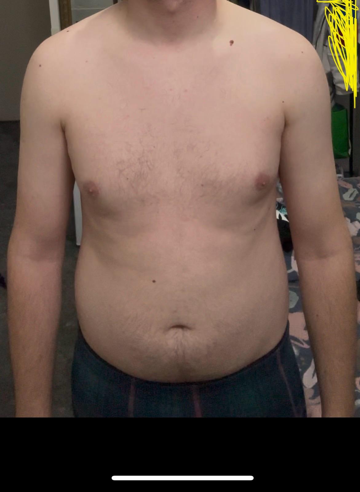 Skinny fat 25 year old male looking for advice v0 fu8j2bvl1ybf1