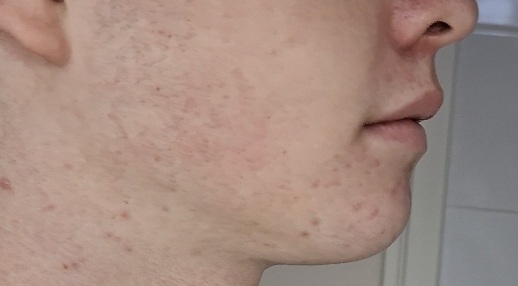 Screenshot 20260121 164501 Video Player