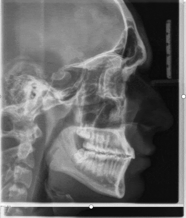 01211 ezgifcom optimize