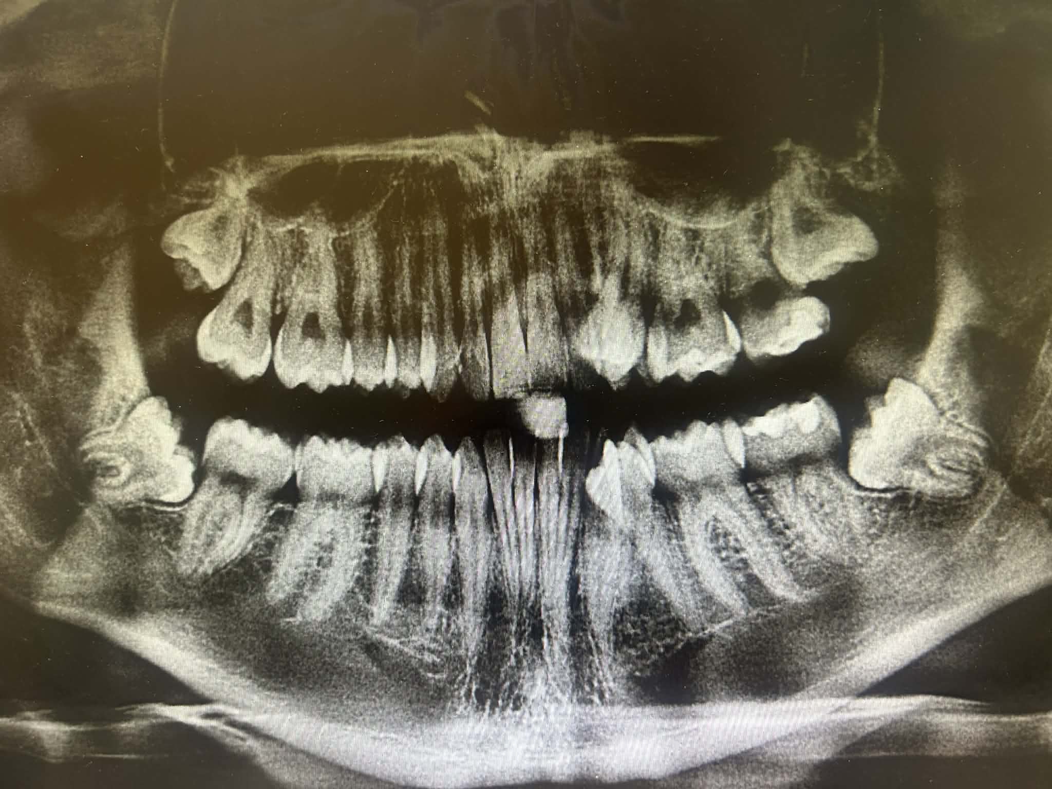 AtthtqblD349t7UgdZANUTyAjc htQd2WMP1QrGNBDfbSQ