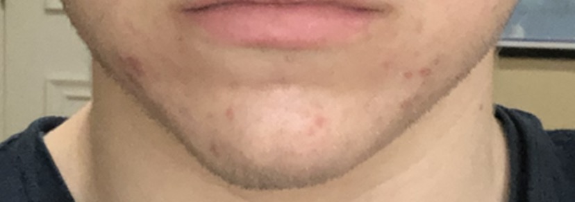 85409144 241E 4740 8220 D0D9045826FE 4 5005 c