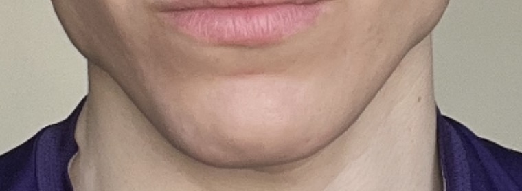 1AA09BC1 7C1A 4A25 8E09 03EDF74BD597 4 5005 c