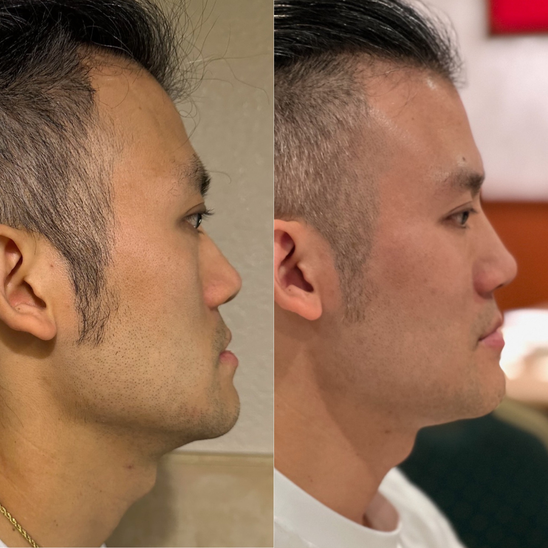 Vance FacialBalancing4