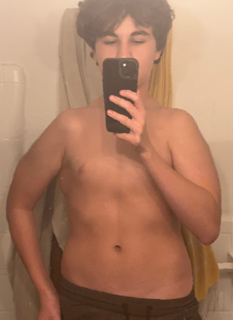 Sick kunt kleinfelter