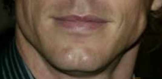 1000064542