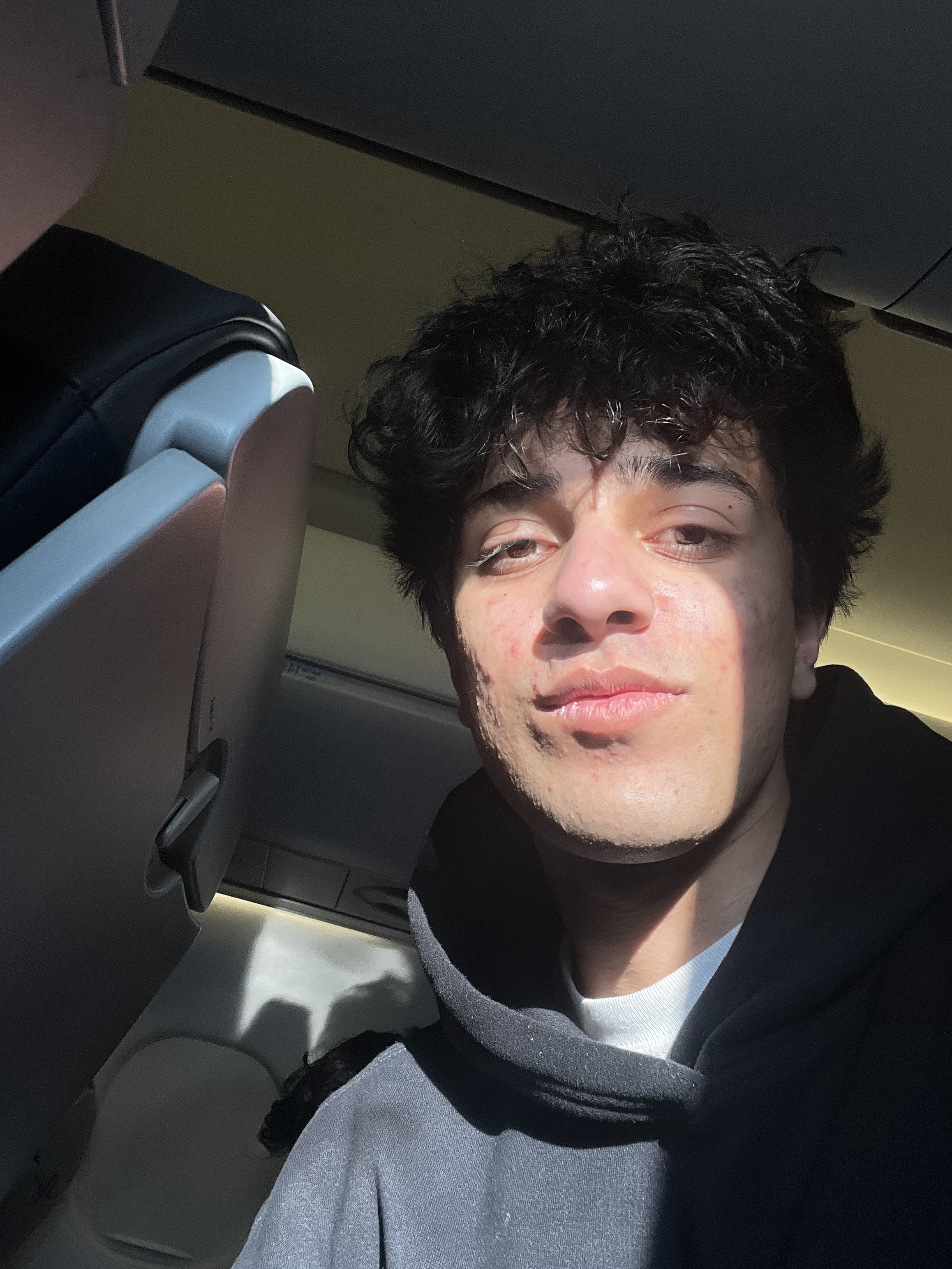 Teeth   Imgur 3