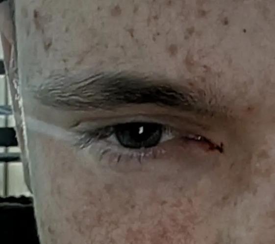 Bruh