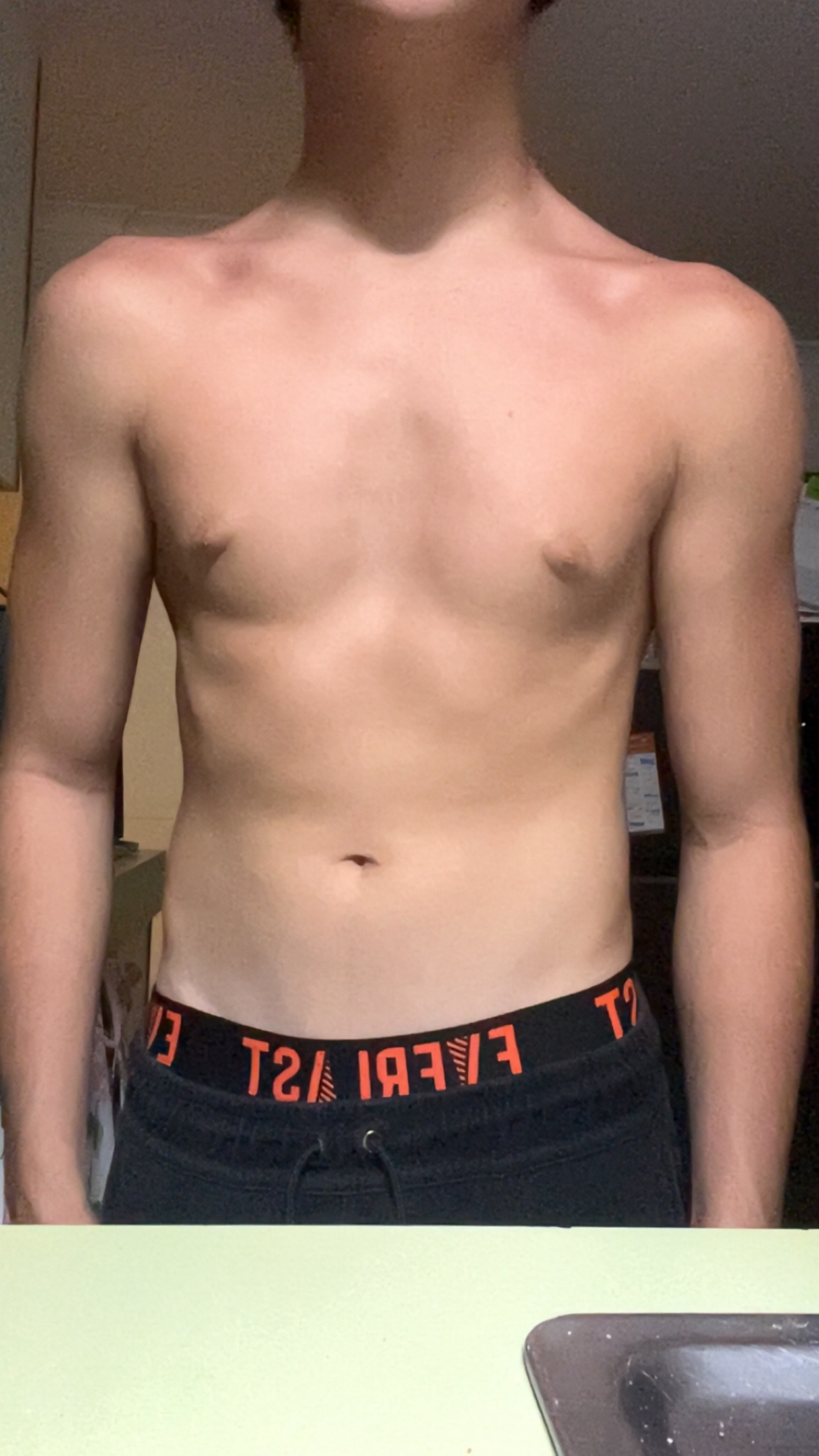 IMG 0915