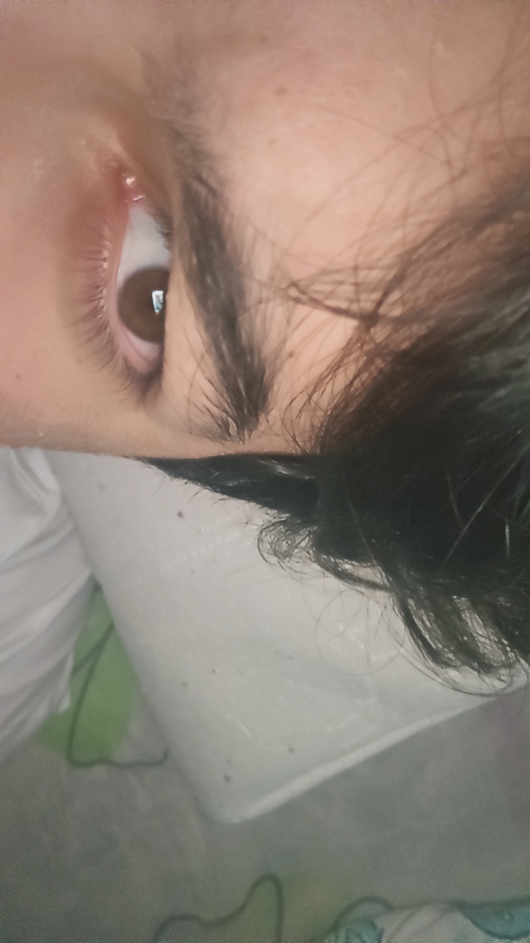 1000036172