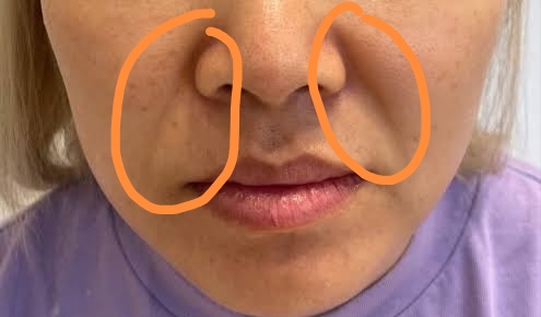 Images 1 edit 103965938325581