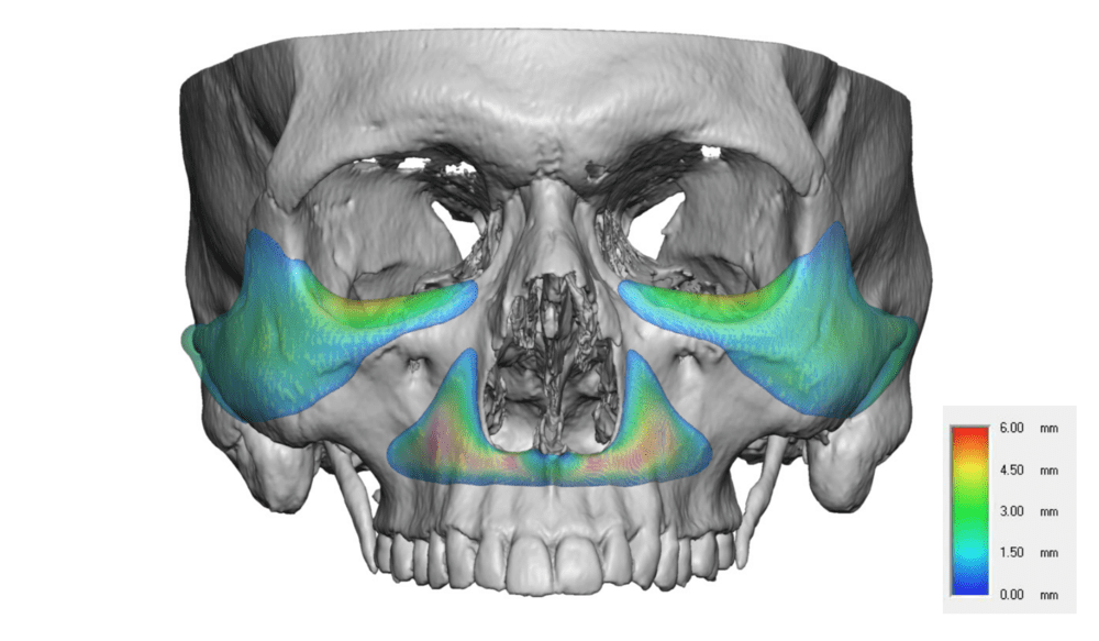 3223992 95DD22F2 F110 4007 9485 45B6CC3514A8