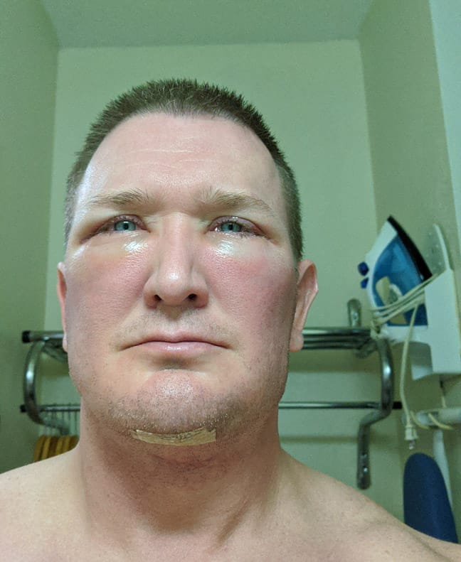 2586821 after 1 t6Ab2LT