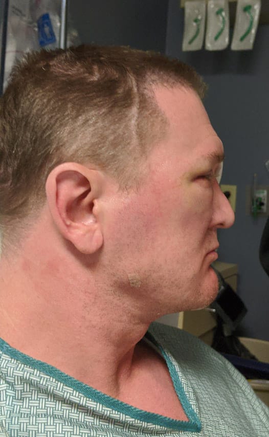 2586822 after 2 pySpkXV