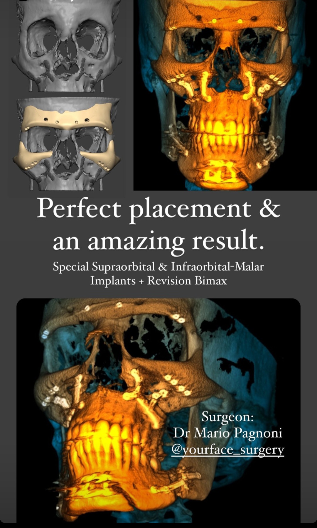 3846331 Screenshot 20231226 175023 Instagram