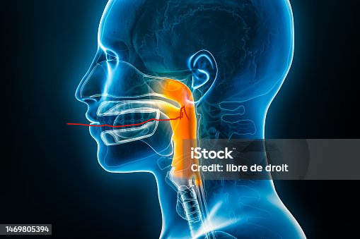 Istockphoto 1469805394 170667a