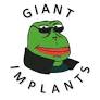giant implants from www.youtube.com