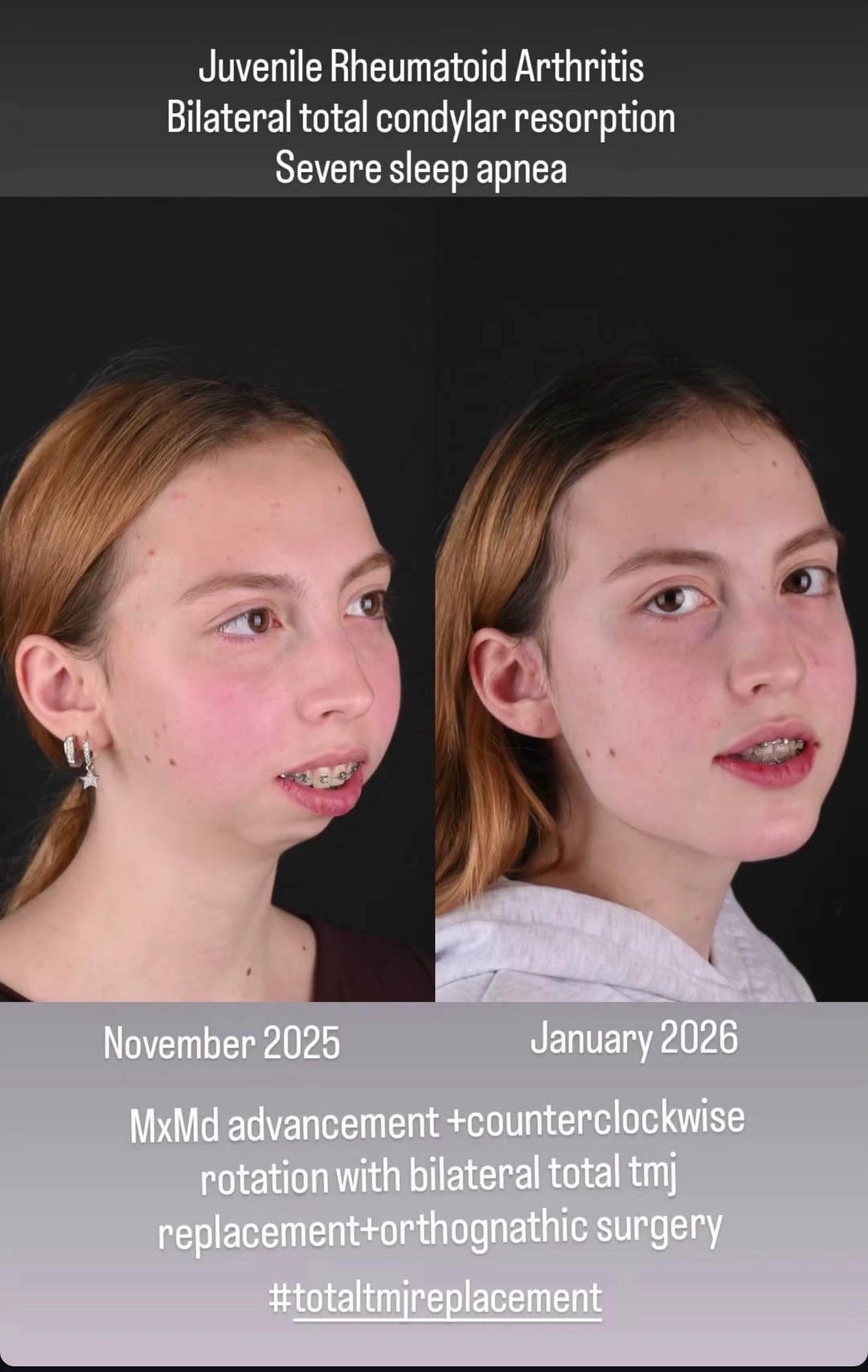 Screenshot 20260131 225755 Instagram