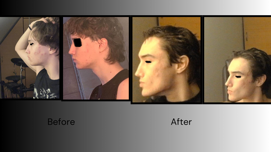 Copy of Bwython Ruined - 1.png