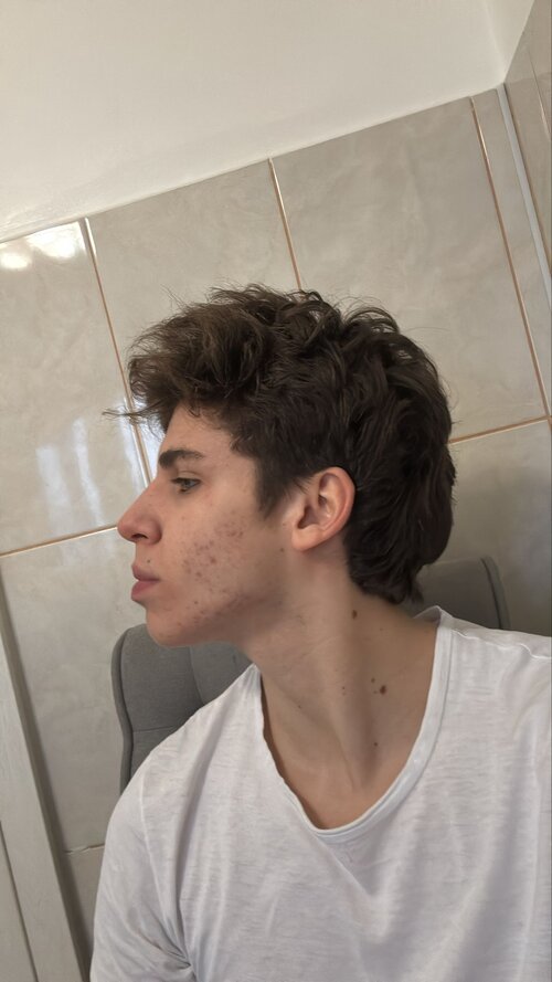 side1.jpeg