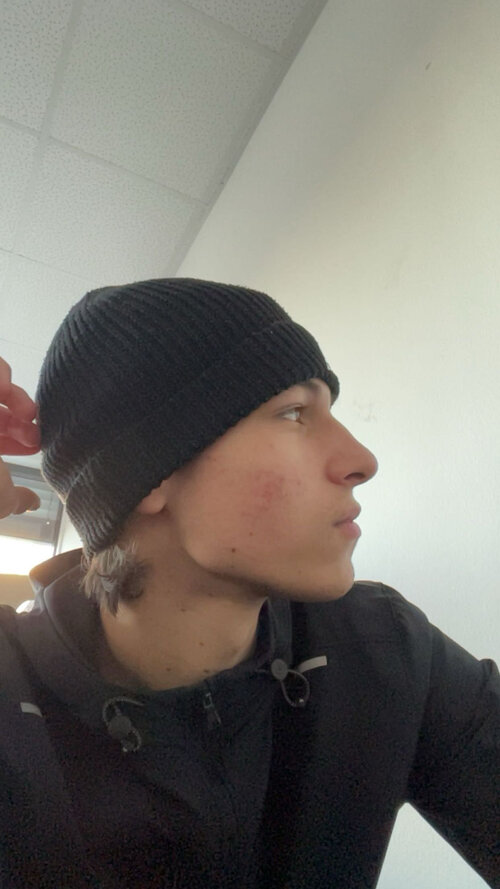 side hbefgf.jpg