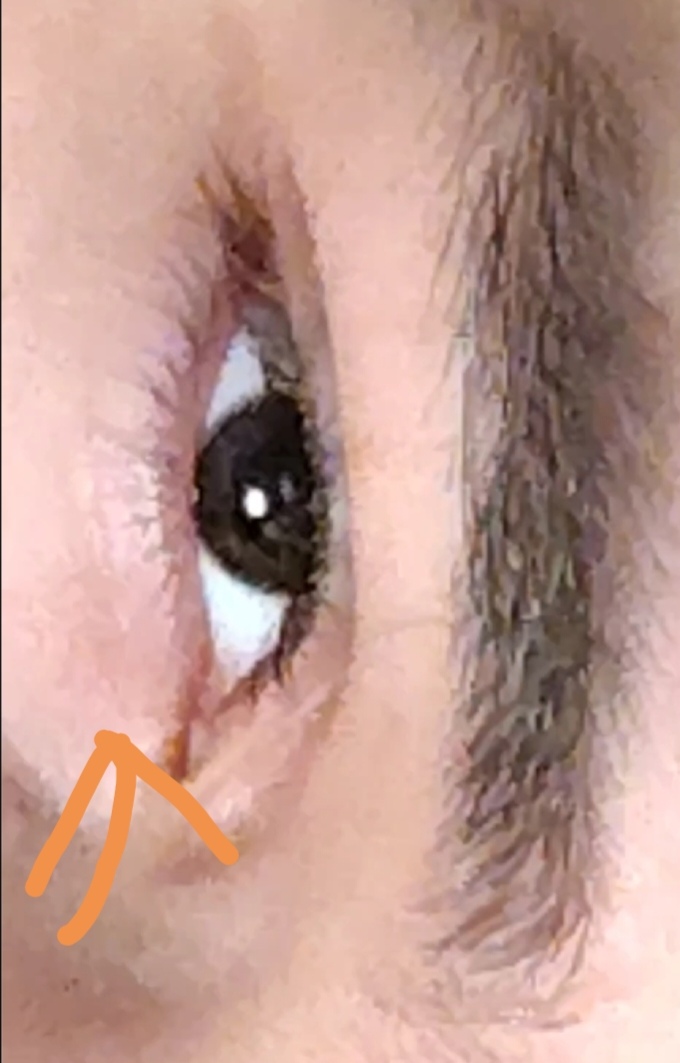1000010650