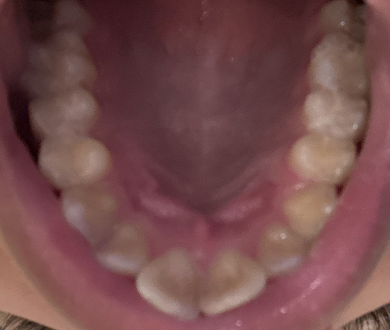 IMG 2355