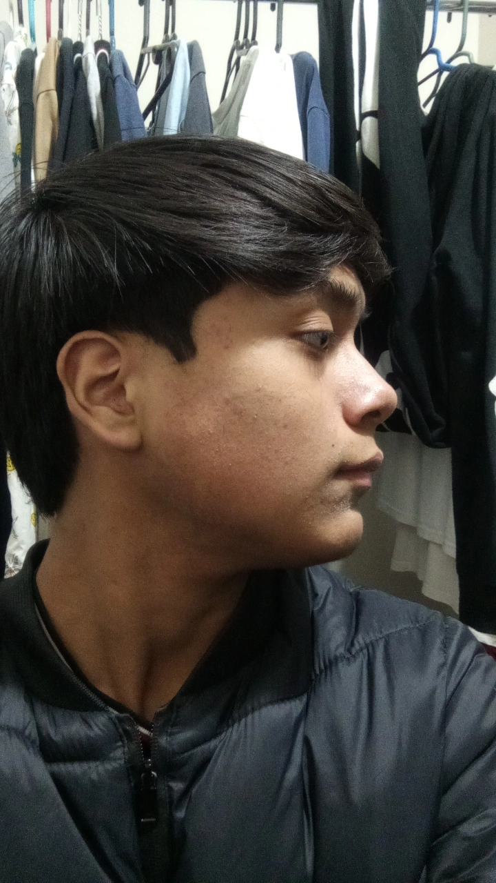 1000041503