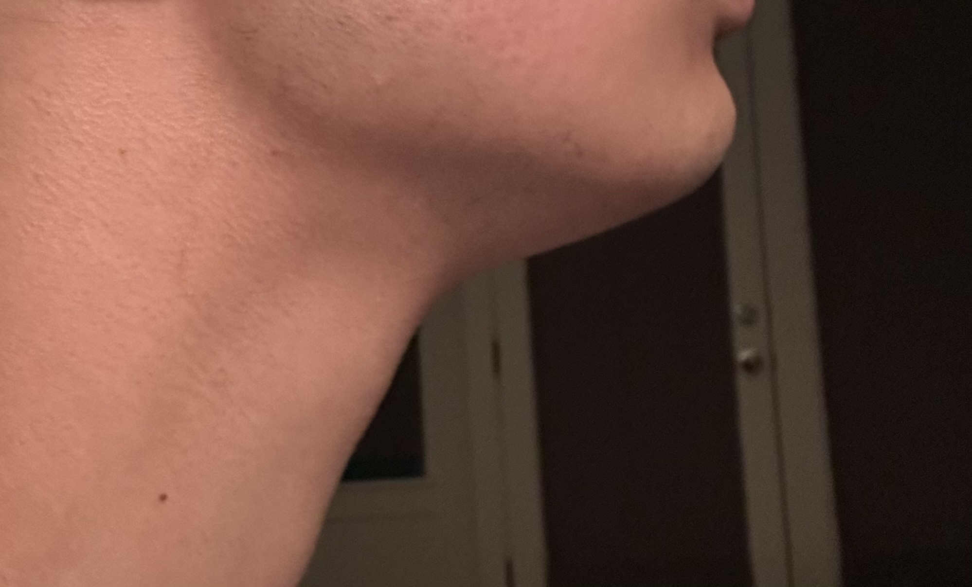 IMG 1525