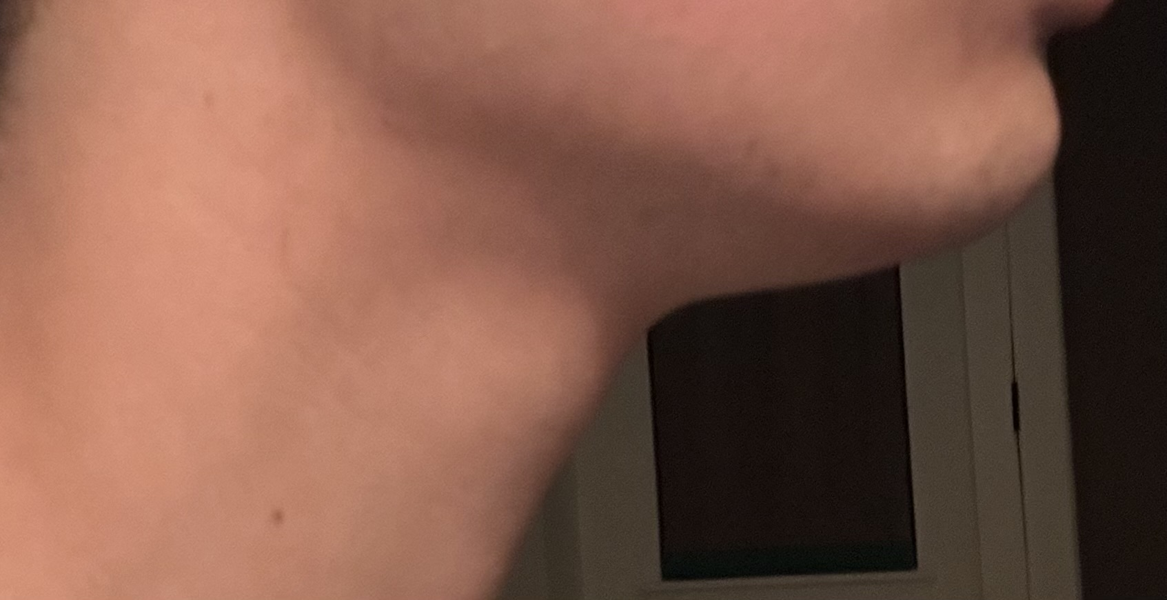 IMG 1522