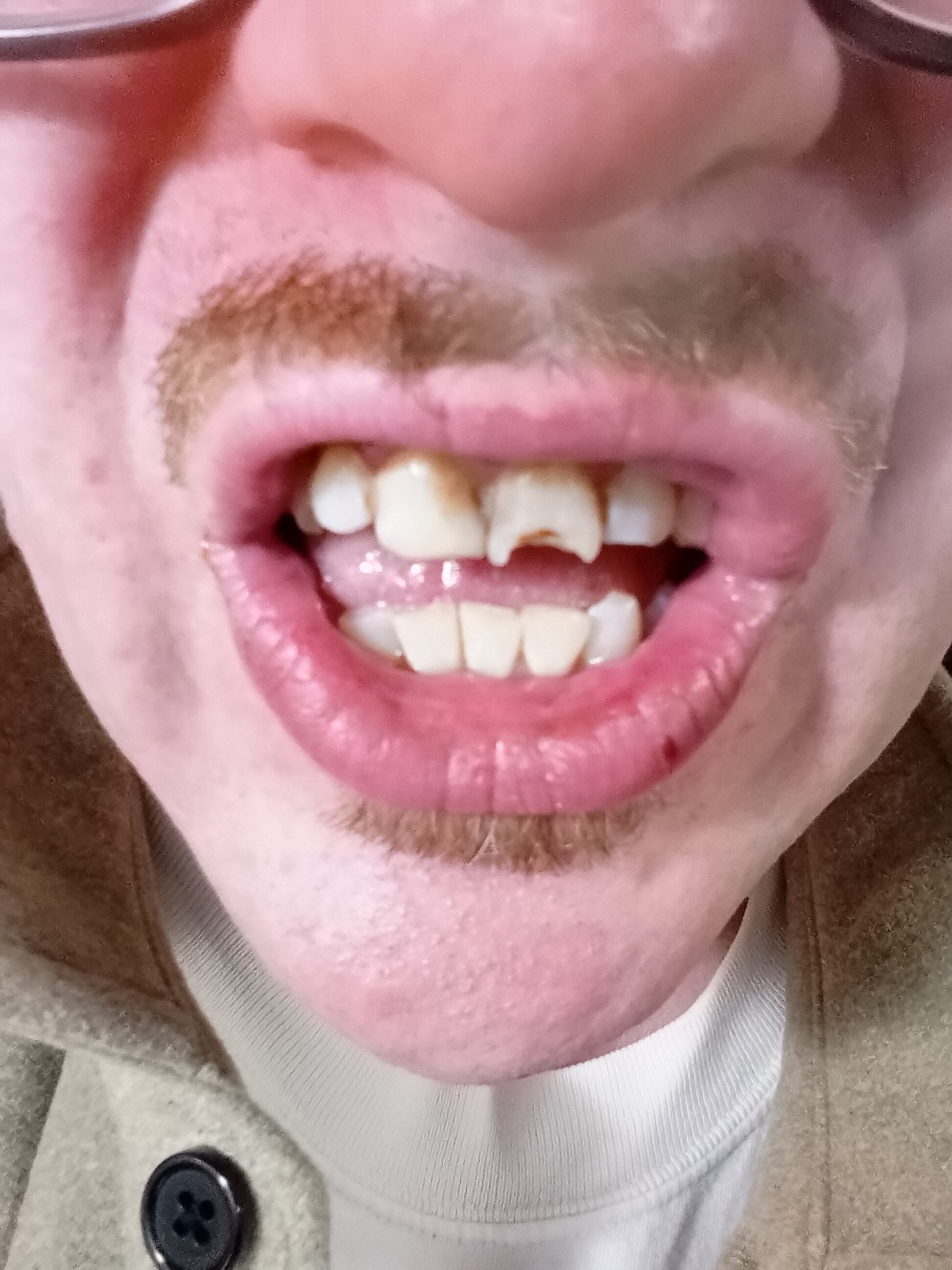 IMG 20251211 002804832