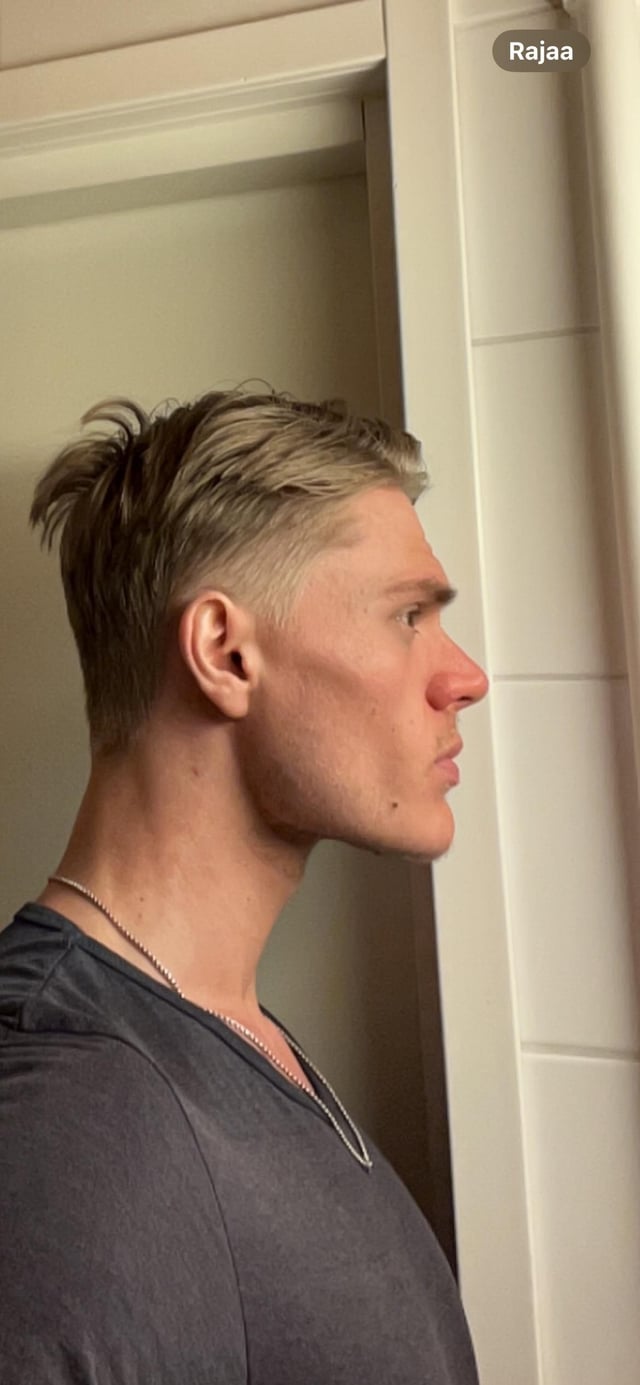 Do i got a good jawline been mewing my whole life without v0 9itjd0mfxw4f1