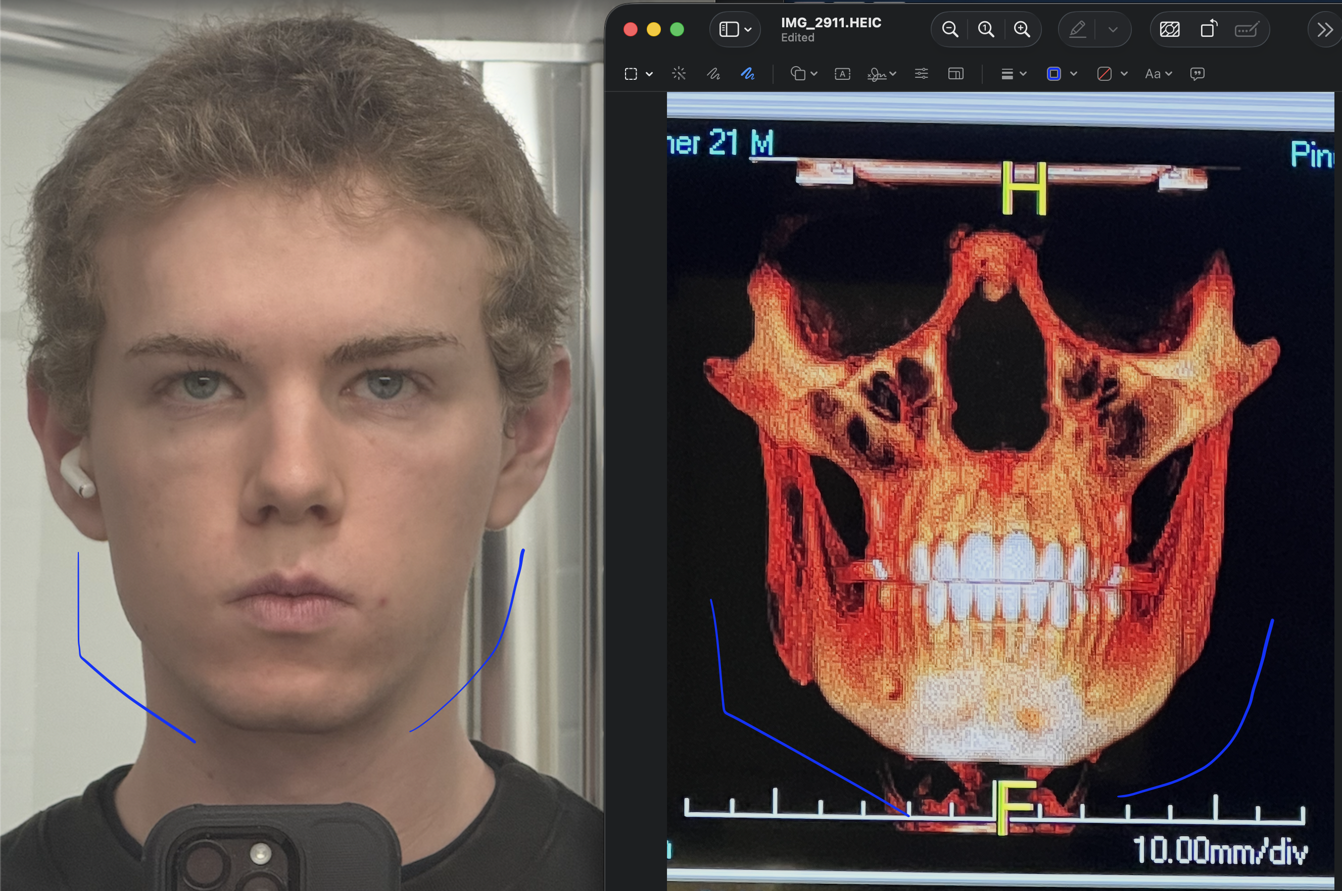 Screenshot 2026 02 06 at 32858PM