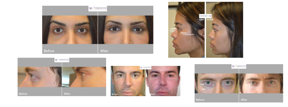 Untitled presentation 7 1